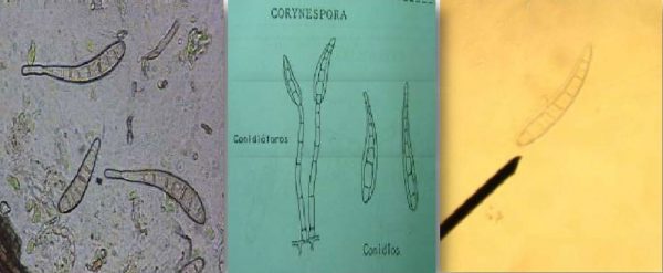 Pudrición de vainas o mancha anillada (Corynespora cassiicola) - Conidiófioros, estructuras del hongo vistas al microscopio